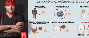 Organik Saç Ekimi