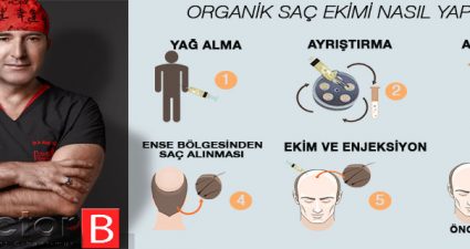 Organik Saç Ekimi