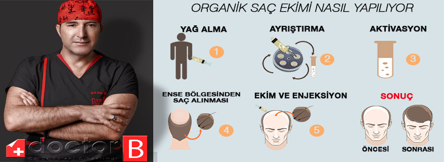 Organik Saç Ekimi